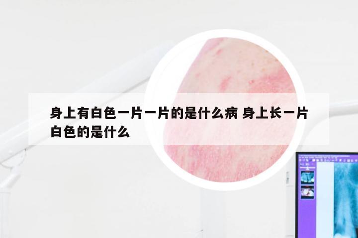 身上有白色一片一片的是什么病 身上长一片白色的是什么