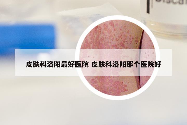 皮肤科洛阳最好医院 皮肤科洛阳那个医院好