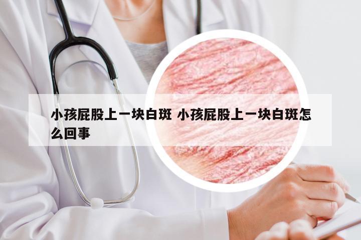 小孩屁股上一块白斑 小孩屁股上一块白斑怎么回事