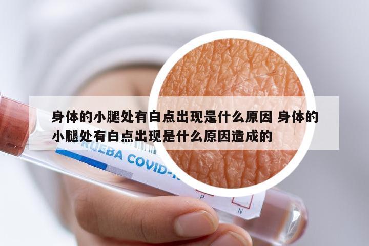 身体的小腿处有白点出现是什么原因 身体的小腿处有白点出现是什么原因造成的