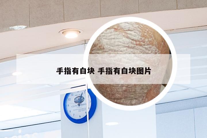 手指有白块 手指有白块图片