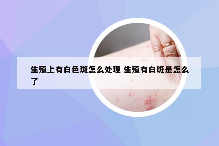 生殖上有白色斑怎么处理 生殖有白斑是怎么了