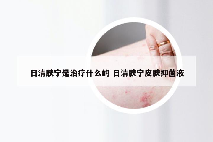 日清肤宁是治疗什么的 日清肤宁皮肤抑菌液