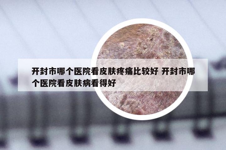 开封市哪个医院看皮肤疼痛比较好 开封市哪个医院看皮肤病看得好