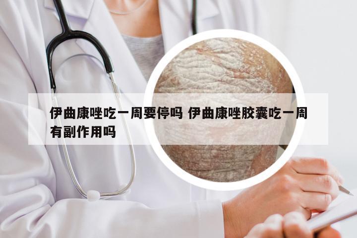 伊曲康唑吃一周要停吗 伊曲康唑胶囊吃一周有副作用吗