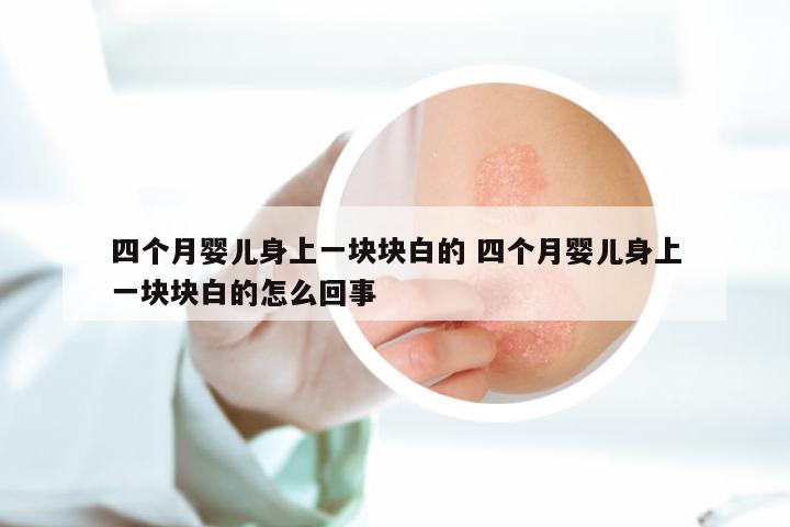 四个月婴儿身上一块块白的 四个月婴儿身上一块块白的怎么回事