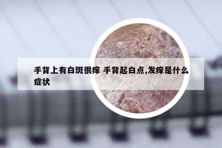 手背上有白斑很痒 手背起白点,发痒是什么症状