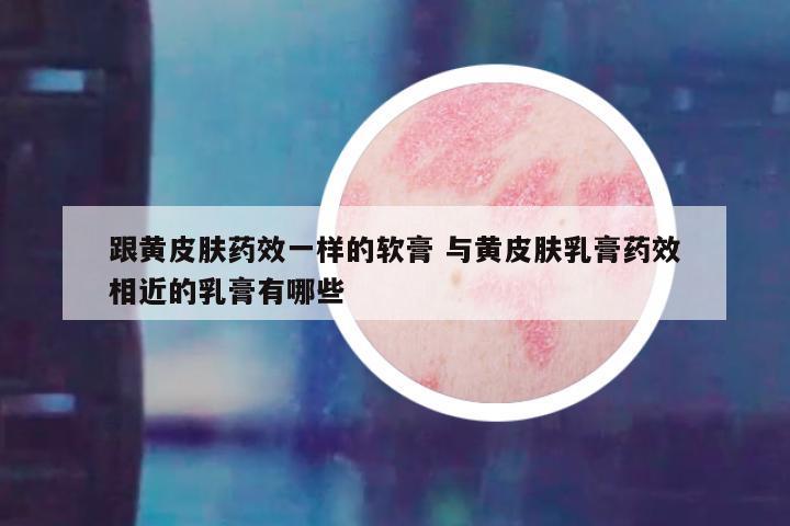 跟黄皮肤药效一样的软膏 与黄皮肤乳膏药效相近的乳膏有哪些