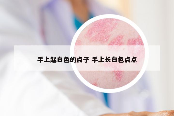 手上起白色的点子 手上长白色点点