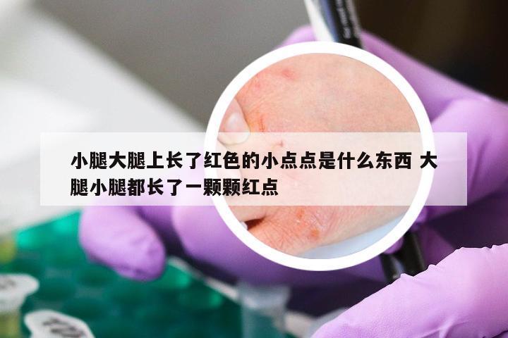 小腿大腿上长了红色的小点点是什么东西 大腿小腿都长了一颗颗红点