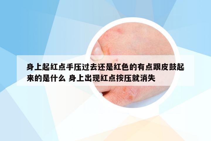 身上起红点手压过去还是红色的有点跟皮鼓起来的是什么 身上出现红点按压就消失