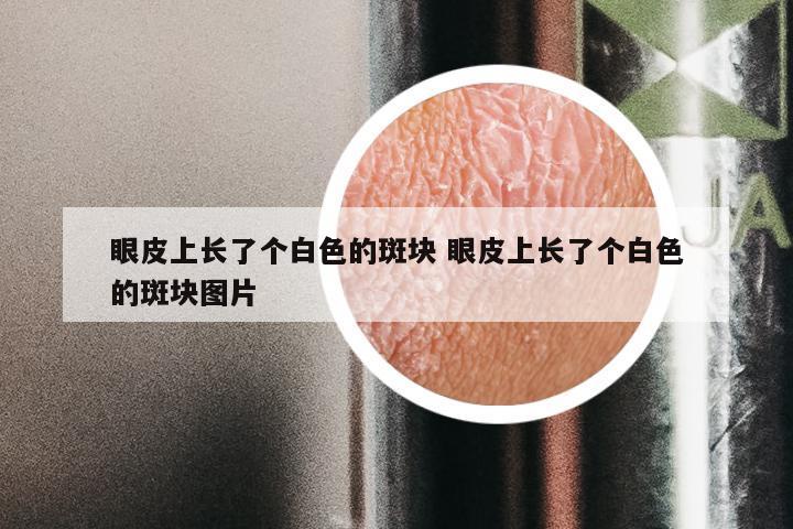 眼皮上长了个白色的斑块 眼皮上长了个白色的斑块图片