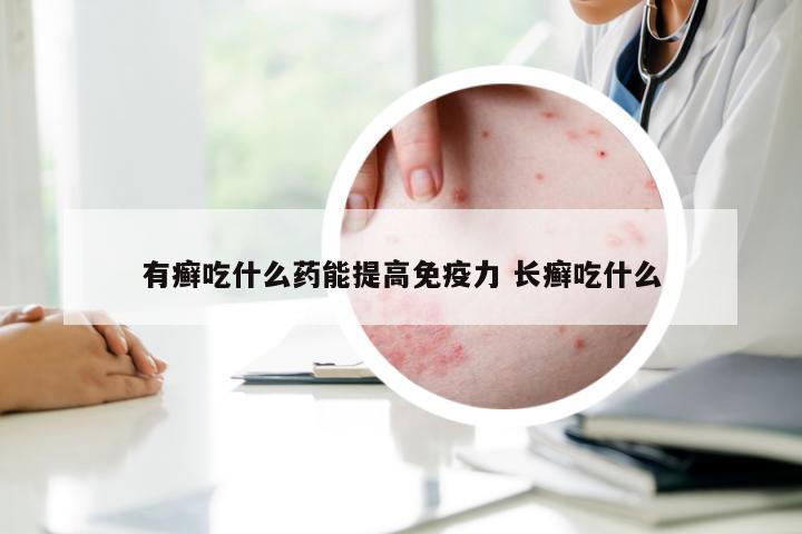 有癣吃什么药能提高免疫力 长癣吃什么