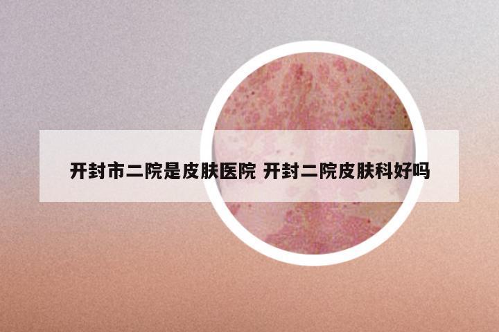 开封市二院是皮肤医院 开封二院皮肤科好吗