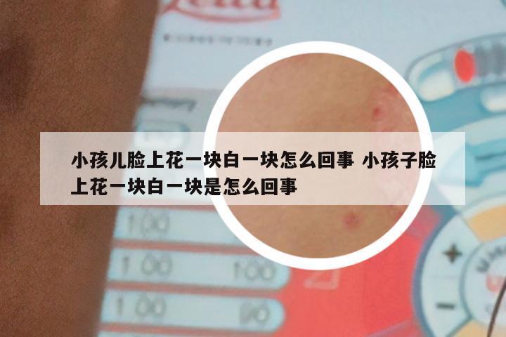 小孩儿脸上花一块白一块怎么回事 小孩子脸上花一块白一块是怎么回事