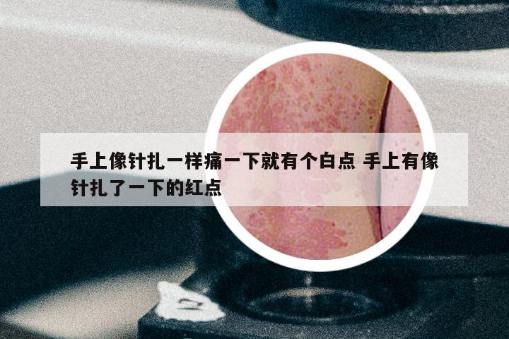 手上像针扎一样痛一下就有个白点 手上有像针扎了一下的红点