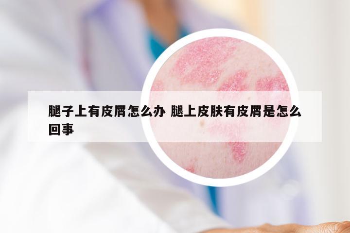 腿子上有皮屑怎么办 腿上皮肤有皮屑是怎么回事