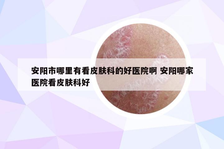 安阳市哪里有看皮肤科的好医院啊 安阳哪家医院看皮肤科好