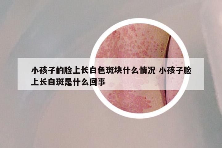 小孩子的脸上长白色斑块什么情况 小孩子脸上长白斑是什么回事
