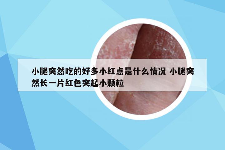 小腿突然吃的好多小红点是什么情况 小腿突然长一片红色突起小颗粒