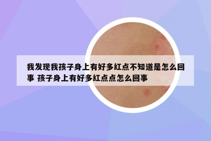 我发现我孩子身上有好多红点不知道是怎么回事 孩子身上有好多红点点怎么回事