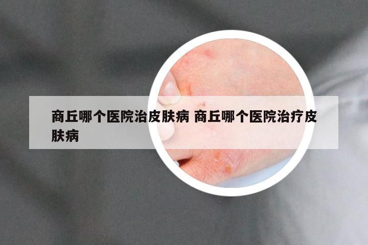 商丘哪个医院治皮肤病 商丘哪个医院治疗皮肤病