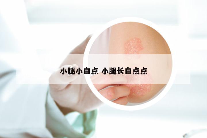 小腿小白点 小腿长白点点