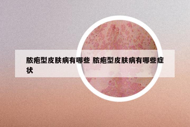 脓疱型皮肤病有哪些 脓疱型皮肤病有哪些症状