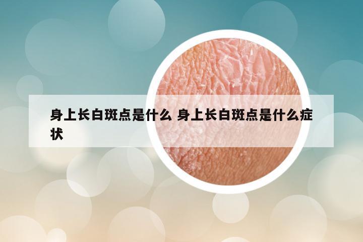 身上长白斑点是什么 身上长白斑点是什么症状