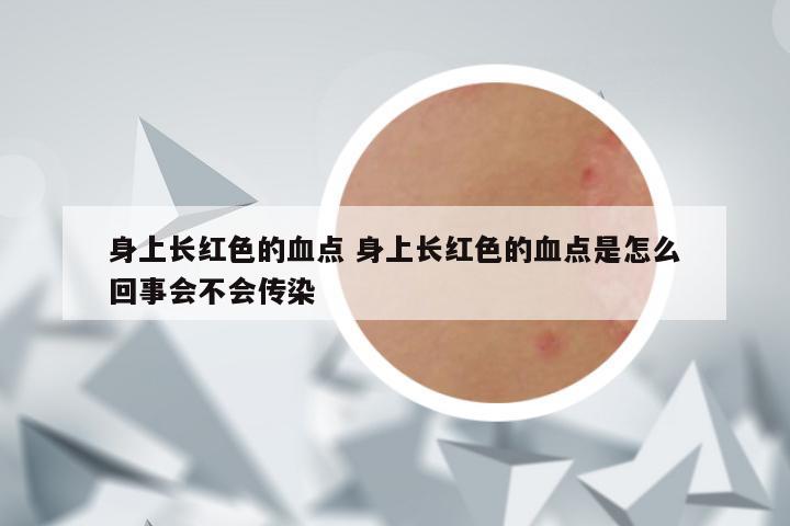 身上长红色的血点 身上长红色的血点是怎么回事会不会传染