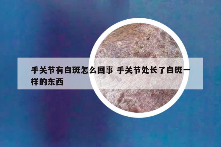 手关节有白斑怎么回事 手关节处长了白斑一样的东西