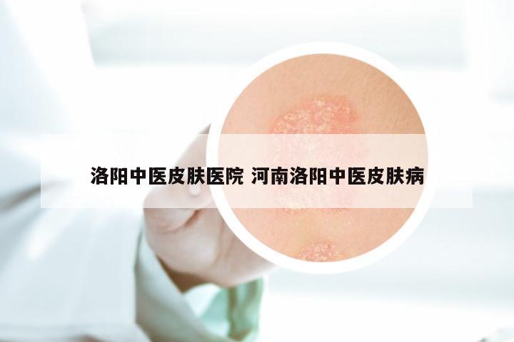 洛阳中医皮肤医院 河南洛阳中医皮肤病