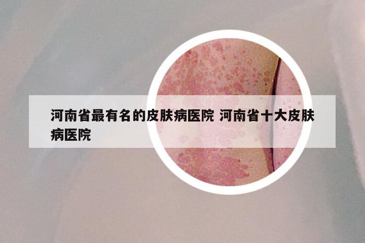 河南省最有名的皮肤病医院 河南省十大皮肤病医院