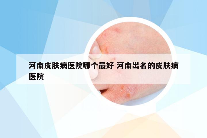 河南皮肤病医院哪个最好 河南出名的皮肤病医院