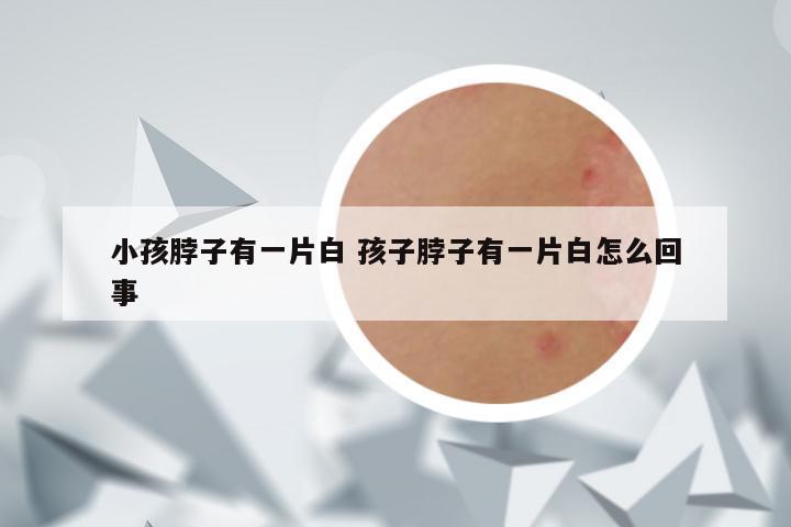 小孩脖子有一片白 孩子脖子有一片白怎么回事