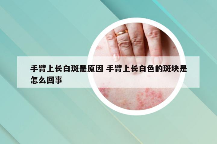 手臂上长白斑是原因 手臂上长白色的斑块是怎么回事