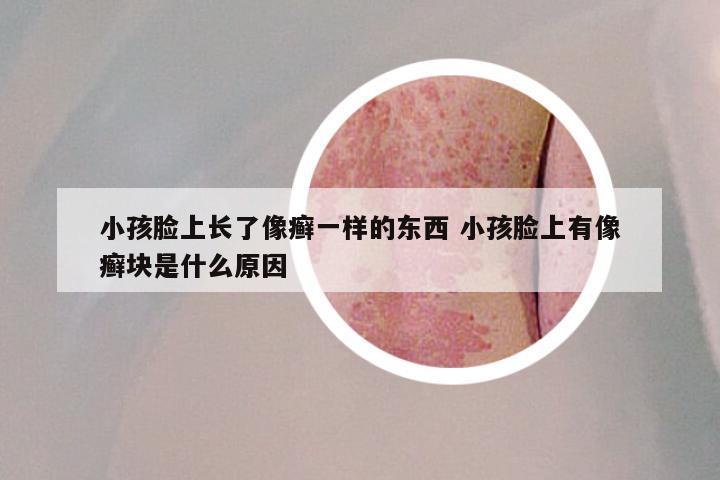小孩脸上长了像癣一样的东西 小孩脸上有像癣块是什么原因