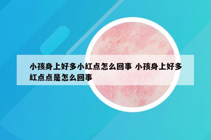 小孩身上好多小红点怎么回事 小孩身上好多红点点是怎么回事