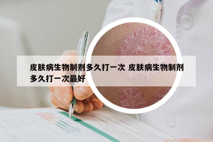 皮肤病生物制剂多久打一次 皮肤病生物制剂多久打一次最好