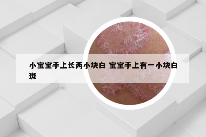 小宝宝手上长两小块白 宝宝手上有一小块白斑