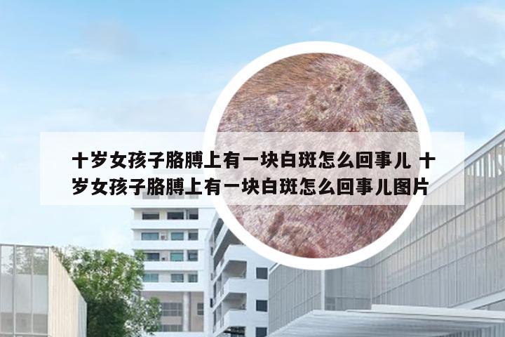 十岁女孩子胳膊上有一块白斑怎么回事儿 十岁女孩子胳膊上有一块白斑怎么回事儿图片