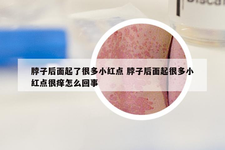 脖子后面起了很多小红点 脖子后面起很多小红点很痒怎么回事