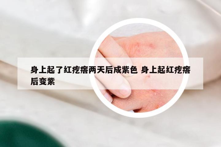 身上起了红疙瘩两天后成紫色 身上起红疙瘩后变紫