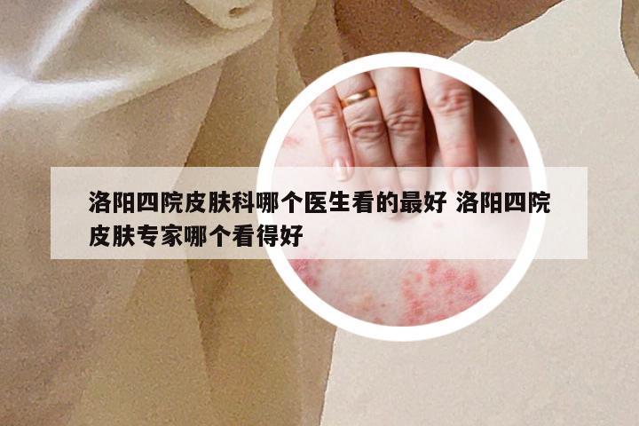 洛阳四院皮肤科哪个医生看的最好 洛阳四院皮肤专家哪个看得好