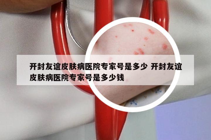 开封友谊皮肤病医院专家号是多少 开封友谊皮肤病医院专家号是多少钱