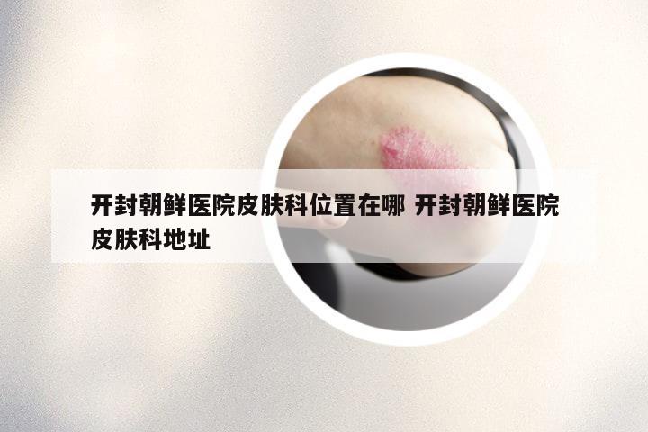 开封朝鲜医院皮肤科位置在哪 开封朝鲜医院皮肤科地址