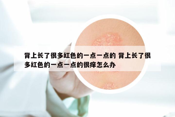 背上长了很多红色的一点一点的 背上长了很多红色的一点一点的很痒怎么办