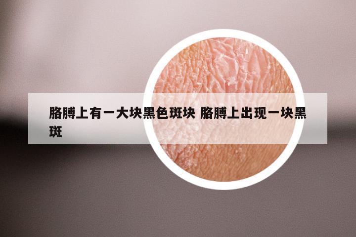 胳膊上有一大块黑色斑块 胳膊上出现一块黑斑