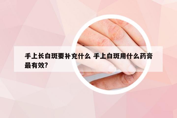 手上长白斑要补充什么 手上白斑用什么药膏最有效?