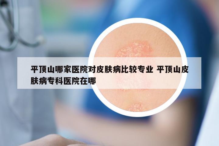 平顶山哪家医院对皮肤病比较专业 平顶山皮肤病专科医院在哪